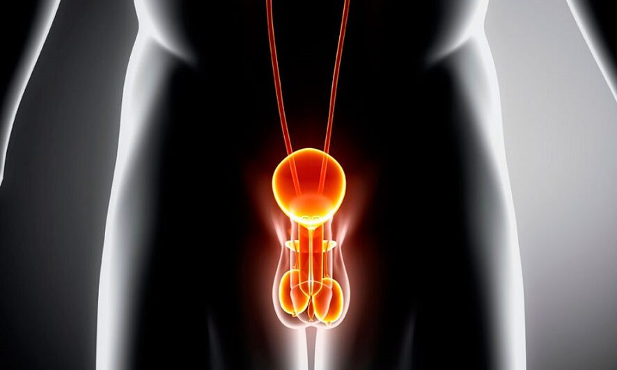 Uždegusi genitalinės prostatito sistema